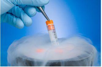 体外受精 IVF-ET